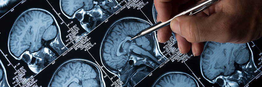 Neuroimaging Neuroimaging