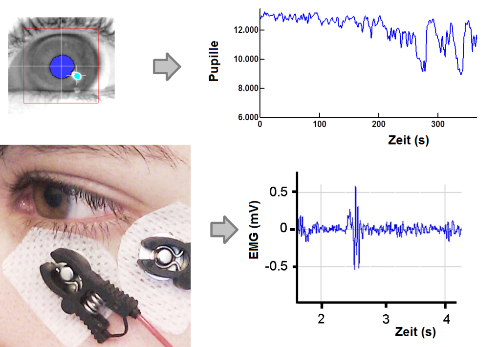 Die Erfassung des Auges mit einer Hochgeschwindigkeitskamera liefert Informationen zu Blickrichtung und Pupillegröße (obere Abbildung). Elektromyographie (EMG) erfasst den Schreckreflex auf ein lautes Geräusch (untere Abbildung).