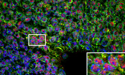 Zac1 (red) and Socs3 (green) expressing neuronal stem cells during the early development of the brain.