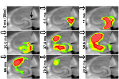 Filmstrip of an activity wave through the hippocampus. The activity wave is triggered by stimulating the input region with a microelectrode (black arrow) and recorded using voltage-sensitive dyes. Warmer colors represent stronger neuronal activity.