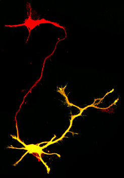 Nerve cells need to communicate with each other to transmit information. Here, the red nerve cell attaches to the yellow one.