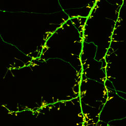 Nerve cells (green) are covered with thousands of small protrusions, the so-called spines (yellow dots). To communicate, other nerve cells attach to the spines. Without neddylation, these spines disappear and nerve cell communication is cut off.