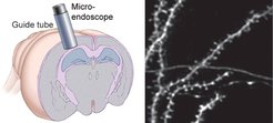 Fig. 1: CA1 chronic imagingWe repeatedly inspect the same CA1 basal dendrites using laser-scanning two-photon imaging to detect dendritic spines in mice.