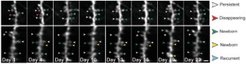 Fig. 2: CA1 dendritic spine turn overIn vivo time-lapse imaging of a basal dendritic segment of CA1 pyramidal neurons labeled for cytoplasmic GFP expression shows spine turnover during a timespan of 21 days.