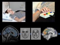 © MPI of Psychiatry