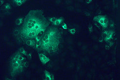 Mit MERS-Coronavirus (grün) infizierte Nierenzellen eines Affen.