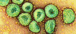 Coloured electron-microscopy image of coronaviruses.