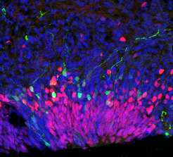 Cerebral organoids mimic the development of our brain in early stages in a Petri dish.