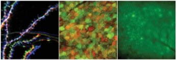 Plastizität des Hippocampus, Repräsentation und Gedächtnis bei Stress