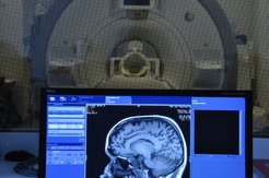 Probands had to solve maths problems in the MRI.