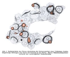 Epithelial cells of the choroid plexus containing Biondi ring tangles. Biondi used the silver impregnation technique with a subsequent sudan coloring. From: Biondi, G. Ein neuer histologischer Befund am Epithel des Plexus chorioideus. Z. f. d. g. Neur. u. Psych. 144, 161–165 (1933). https://doi.org/10.1007/BF02870278