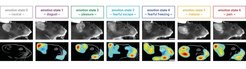 Facial videography and subsequent machine vision analyses are used to precisely track distinct emotion states in mice.