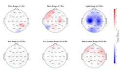 Diese Abbildung zeigt topografische Karten, aus denen hervorgeht, wie gut sich Schizophrenie-PatientInnen anhand unterschiedlicher Hirnwellenmuster in verschiedenen Frequenzbereichen von gesunden Personen unterscheiden lassen. Die Frequenzbereiche umfassen Delta (1-3 Hz), Theta (3-7 Hz), Alpha (8-11 Hz), Beta (12-19 Hz), niedriges Gamma (20-49 Hz) und hohes Gamma (50-70 Hz). Die Farbintensität zeigt die Stärke der Vorhersage an; tiefere Farben stehen für eine stärkere Vorhersagekraft. Eine verringerte Aktivität im Alpha-Frequenzband ist besonders starker Indikator für schizophrenieähnliche Züge, wie auf den Karten hervorgehoben wird.