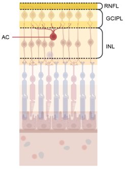 Retinale Nervenschicht (RNFL), Ganglienzell- und innere plexiforme Schicht (GCIPL), innere Körnerschicht (INL), und Amakrinzellen (AC) der Netzhaut. Die GCIPL, die synaptische Schicht der AC, war bei höherem genetischen Risiko für Schizophrenie dünner.