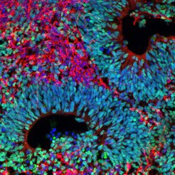 Cerebral organoids mimic the development of our brain in early stages in a Petri dish