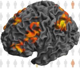  Translational Neuromodeling: Towards Computational Assays for Psychiatry 