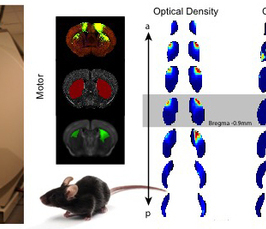 Novel functional imaging tools to study the organization of the brain in health and disease