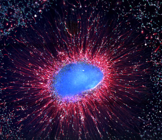 Building stem cell-based models to decode human brain-microglia interactions in health and disease Building stem cell-based models to decode human brain-microglia interactions in health and disease