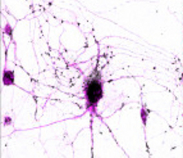 Overcoming barriers in Direct Neuronal Reprogramming for disease modeling and brain repair Overcoming barriers in Direct Neuronal Reprogramming for disease modeling and brain repair